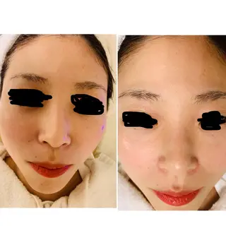 aliaハイフ&水光ジェットサロン所属・aliaハーブ水光店 エステティシャン募集のエステ・リラクイメージ