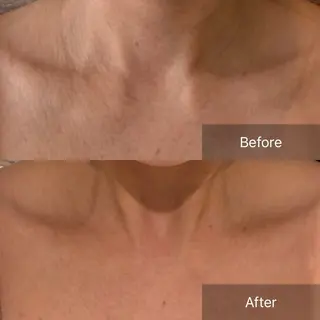 Charis エステ&ネイルのエステ・リラクイメージ