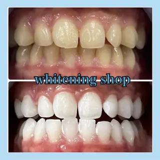 ホワイトニング ショップ千葉店のその他イメージ