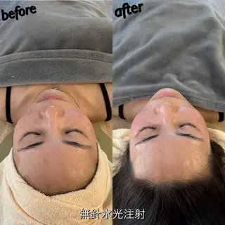 うなじ脱毛/美肌脱毛 LABELのエステ・リラクイメージ