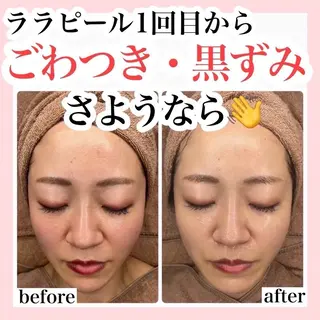 ハーブピーリング/ ララピール専門店のエステ・リラクイメージ