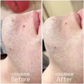 宮代・脱毛サロンMIIN所属・脱毛・ホワイトニング 耳ツボ・美白・毛穴のその他イメージ