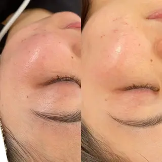 【骨格診断📝 最強似合わせ眉✨】のエステ・リラクイメージ