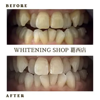 メンズ ホワイトニング ショップ葛西店のその他イメージ