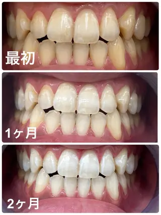 cona whitening神保町所属・ホワイトニング 神保町店/杉浦のエステ・リラクイメージ