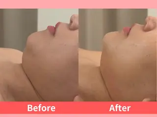 痩身Relives 金町店のその他イメージ