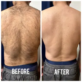 メンズ メンズ脱毛サロン shavys所属・shavys せいじのエステ・リラクイメージ