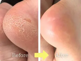 ネイル franfika 星野のネイルデザイン