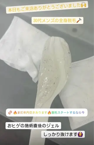 メンズ 脱毛サロン BRIDGE橋本のエステ・リラクイメージ