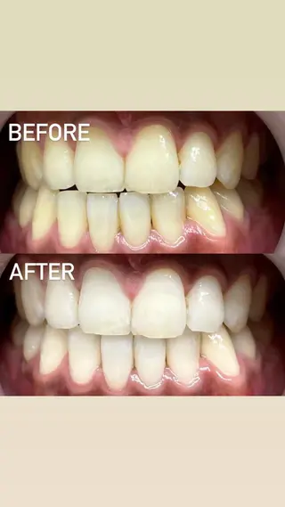 LBSホワイトニング 銀座店💎店長浦和のその他イメージ