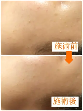 小顔・毛穴・たるみ ネイル　似内真樹のエステ・リラクイメージ