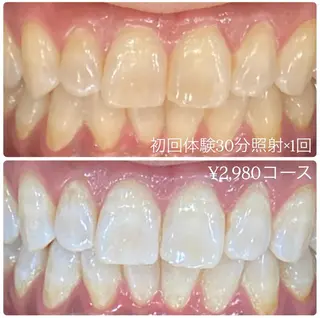 PLATINUM Beauty 横浜店所属・ホワイトニングルーム 横浜店のその他イメージ