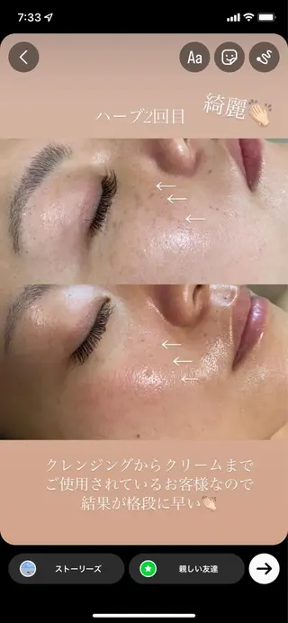 Charme Esbeaute所属・南森町 ｃｅのマツエク・マツパデザイン