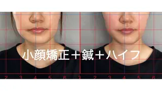 そノさき所属・大阪のシーサー🦁 島袋のエステ・リラクイメージ