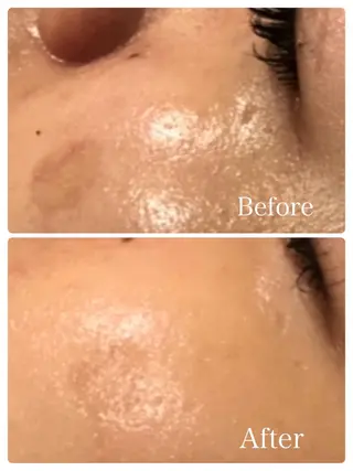 L’Beige レベージュのエステ・リラクイメージ