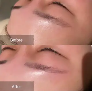 アイブロウ for woman所属・森 美優のエステ・リラクイメージ