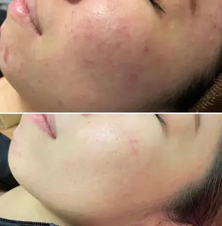 Mixture～ﾐｸｽﾁｬｰ～所属・バスト·毛穴サロン Mixtureのエステ・リラクイメージ