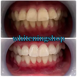 ホワイトニング ショップ吉祥寺店のエステ・リラクイメージ