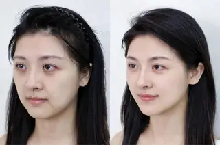 マツエク・マツパ aliaハイフ&水光ジェットサロン所属・aliaハーブ水光店 エステティシャン募集のエステ・リラクイメージ