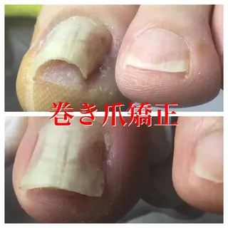 メンズ ネイル ドクターネイル爪革命 takahashiのその他イメージ