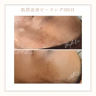 小顔×肌質改善サロン soin〔ソワン〕のエステ・リラクイメージ