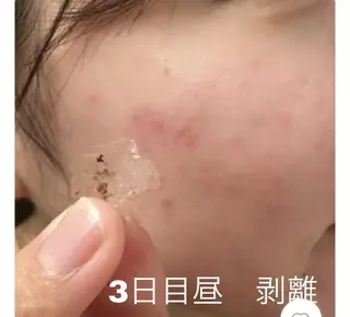 レイビス 渋谷店のエステ・リラクイメージ