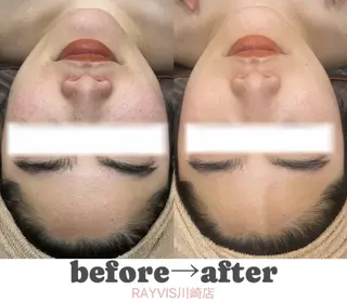 🌷U24毛穴エステ レイビス川崎🌷のエステ・リラクイメージ