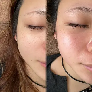 Nalu所属・まつ毛パーマ／脱毛 Naluのエステ・リラクイメージ