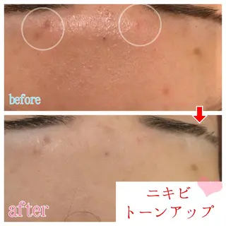 セミロング カラー パーマ ヘアアレンジ メンズ キッズ ネイル マツエク・マツパ 四つ星サロン🎖 腸＆ニキビケアに特化のエステ・リラクイメージ