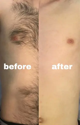 YES脱毛サロン　大阪京橋店所属・メンズ脱毛サロン YESのエステ・リラクイメージ