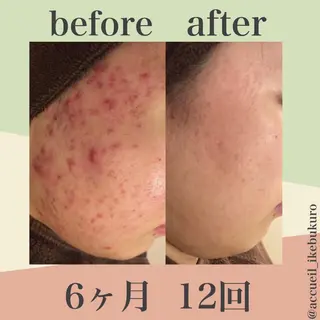 ミディアム カラー パーマ ヘアアレンジ メンズ キッズ ネイル マツエク・マツパ ニキビ・肌質改善専門 ♡人生が変わるサロンのエステ・リラクイメージ