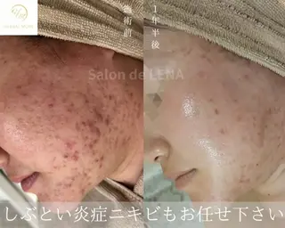 Grandir所属・ハーブピーリング専門 グランディール　武内のエステ・リラクイメージ