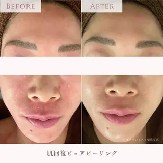 肌質改善サロン LesFleursのエステ・リラクイメージ