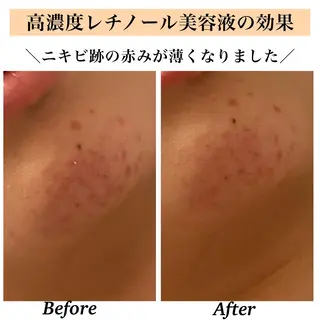 Bellesthe （ベルエステ）のエステ・リラクイメージ