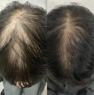 Blooming所属・LOUISE. ／肌質・頭皮のエステ・リラクイメージ