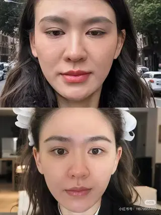 カラー aliaハイフ&水光ジェットサロン所属・aliaハーブ水光店 エステティシャン募集のエステ・リラクイメージ