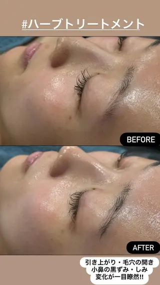 LiZA エステティックサロンのエステ・リラクイメージ