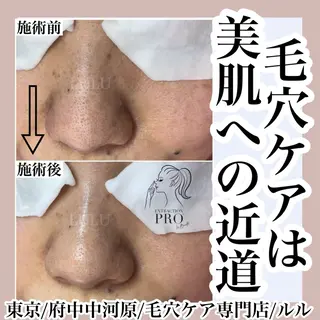 LULU所属・LULU ルルのエステ・リラクイメージ