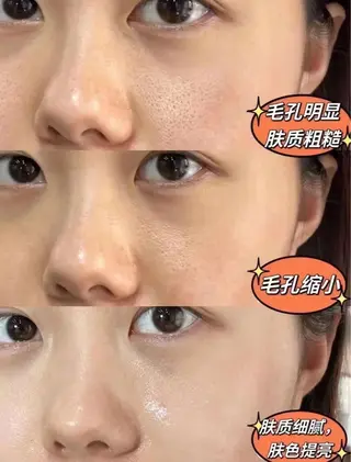 ネイル aliaハイフ&水光ジェットサロン所属・aliaハーブ水光店 エステティシャン募集のエステ・リラクイメージ