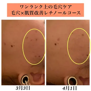 Bellesthe （ベルエステ）のエステ・リラクイメージ