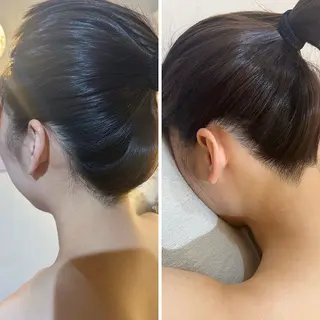 うなじ脱毛/美肌脱毛 LABELのエステ・リラクイメージ