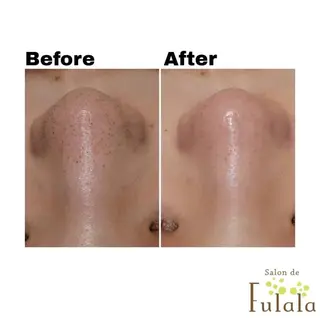 Fulala 永田のエステ・リラクイメージ