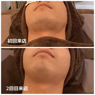 メンズ メンズ脱毛ECXIA所属・men's脱毛サロン ECXIAのエステ・リラクイメージ