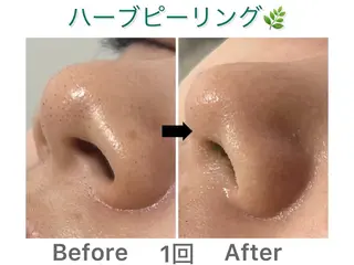 エステサロンNarcis〜ナルシス〜所属・脱毛＆痩身エステ Narcisのエステ・リラクイメージ