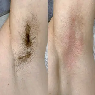 メンズ 佐々木 ちゆきのエステ・リラクイメージ