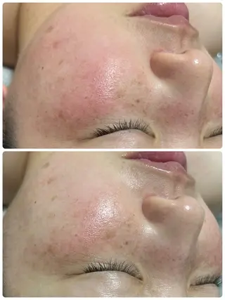 esthesalon Ran所属・小顔美肌痩身サロン Ranのその他イメージ