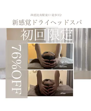 頭ｽｯｷﾘ疲労回復 ﾄﾞﾗｲﾍｯﾄﾞのエステ・リラクイメージ