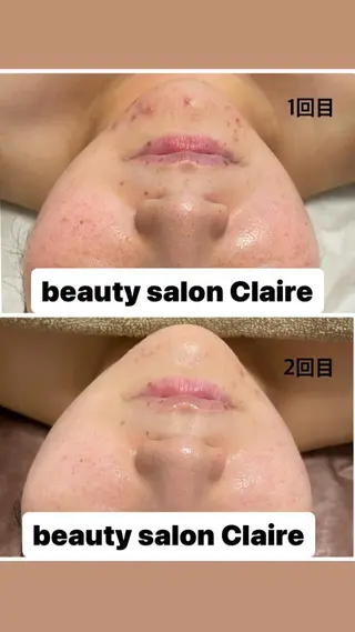 ビューティーサロン Claireのエステ・リラクイメージ