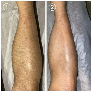 メンズ 脱毛サロン　セラヴィ 吉祥寺 KEITAのエステ・リラクイメージ