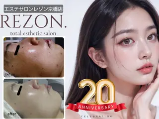 ニキビケア&ニキビ跡 レゾン京橋店 のエステ・リラクイメージ